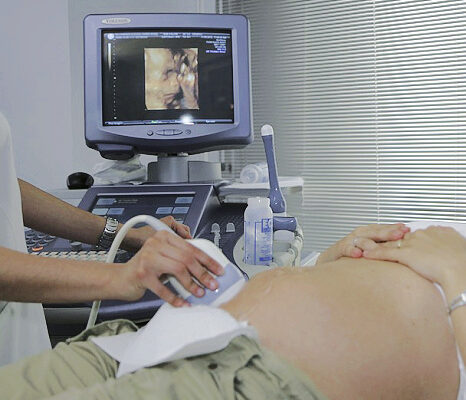 What to Expect at Your 20-Week Ultrasound