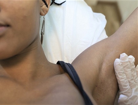 Top Reasons to Choose Laser Hair Removal