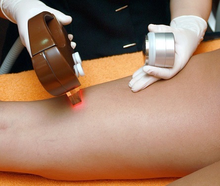 Get Hair-Free, Silky Skin with Laser Hair Removal