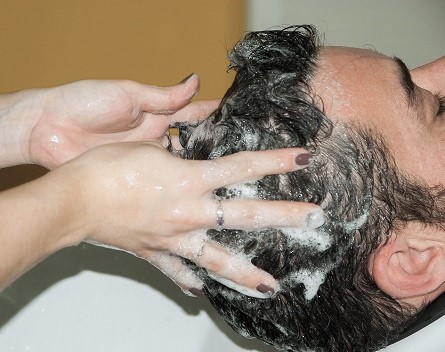 What Really Works for Dandruff? Today's Top Choices for Lasting Relief